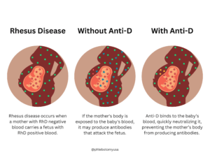 Rhesus Disease and Anti-D